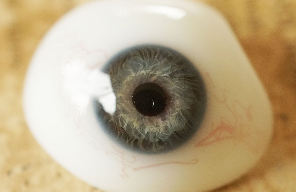 信報 摘除眼球手術之後可進行眼窩整形 中大眼科cuhk Dovs